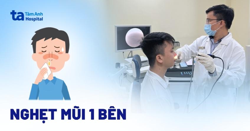 Bị nghẹt mũi 1 bên: Nguyên nhân, triệu chứng và phòng ngừa