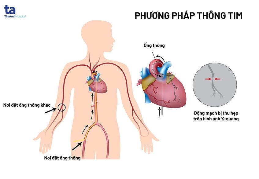 phuong phap thong tim