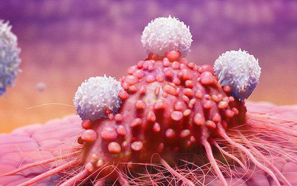 7 loại ung thư có khả năng chữa khỏi nếu phát hiện sớm