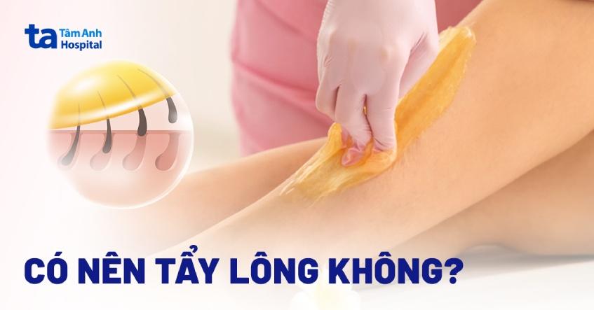 tẩy lông