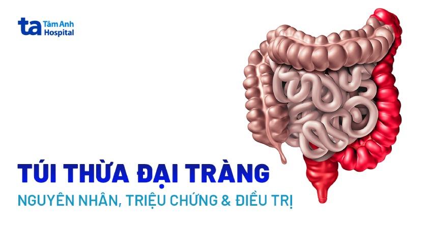 bệnh túi thừa đại tràng