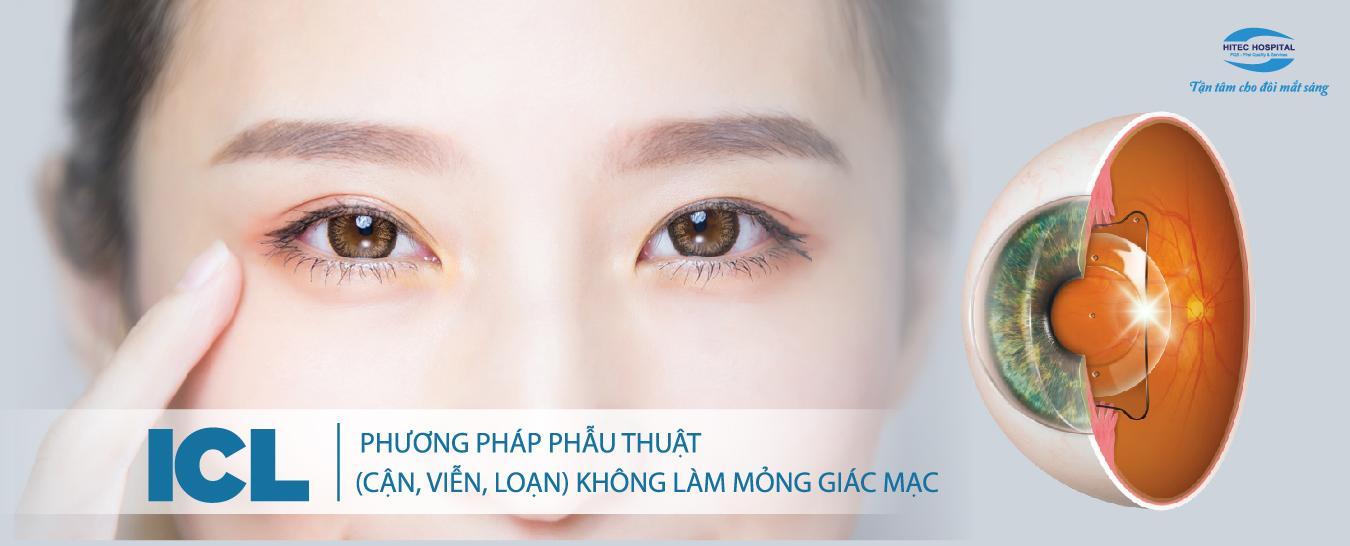 Phẫu thuật ICL