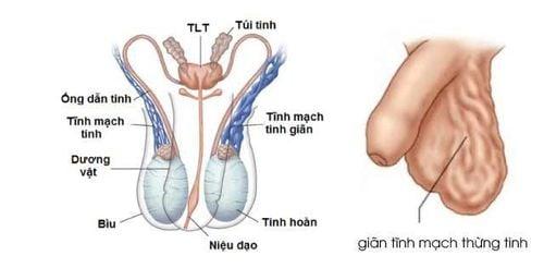 Một số bệnh phổ biến chỉ có ở nam giới