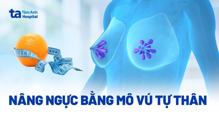 Nâng ngực bằng mô vú tự thân (vạt mô): Phương pháp và chỉ định