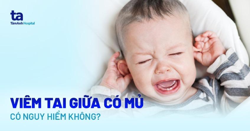 bệnh viêm tai giữa ứ mũ